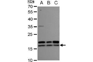 WB Image nm23-H2 antibody detects nm23-H2 protein by western blot analysis. (NME2 Antikörper  (Center))