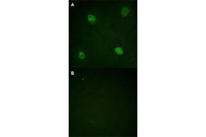Immunofluorescence staining of methanol-fixed HeLa cells with HNRNPD (phospho S83) polyclonal antibody  without blocking peptide (A) or preincubated with blocking peptide (B) at 1:100-1:200 dilution. (HNRNPD/AUF1 Antikörper  (pSer83))