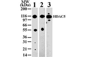 Western blot analysis of HDAC5 in 293 (lane 1) , Jurkat (lane 2) and NIH-3T3 (lane 3) cell lysate with HDAC5 polyclonal antibody  . (HDAC5 Antikörper  (AA 572-587))