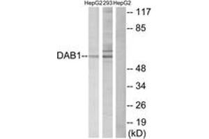 Western blot analysis of extracts from HepG2/293 cells, using Dab1 (Ab-232) Antibody.