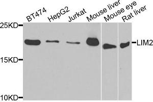 Western blot analysis of extracts of various cell lines, using LIM2 antibody. (LIM2 Antikörper)