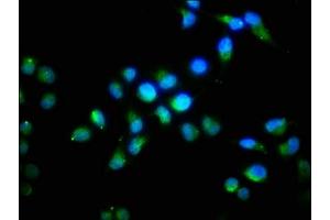 Immunofluorescence staining of Hela cells with ABIN7152772 at 1:96, counter-stained with DAPI. (FGF1 Antikörper  (AA 16-155))