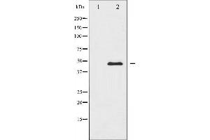 Western blot analysis of CaMK2 alpha/delta expression in NIH-3T3 whole cell lysates,The lane on the left is treated with the antigen-specific peptide. (CaMK2 alpha/delta Antikörper)