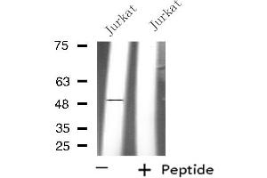 Western blot analysis of extracts from Jurkat cells, using PPM1L antibody.