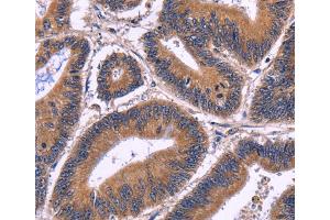 Immunohistochemistry (IHC) image for anti-Spermatogenesis Associated 7 (SPATA7) antibody (ABIN2428779) (SPATA7 Antikörper)