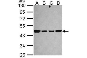 WB Image Sample (30 ug of whole cell lysate) A: 293T B: A431 , C: JurKat D: Raji 10% SDS PAGE antibody diluted at 1:1000