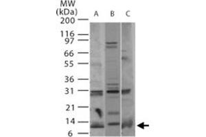 Western blot analysis of Pmaip1 in A) human, B) mouse, and C) rat thymus tissue using Pmaip1 polyclonal antibody  at 2 ug/mL . (NOXA Antikörper  (AA 51-66))