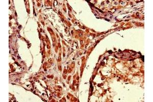 Immunohistochemistry of paraffin-embedded human testis tissue using ABIN7174691 at dilution of 1:100 (ARRDC1-AS1 (AA 1-176) Antikörper)