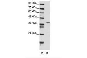 Image no. 1 for anti-Mesenchyme Homeobox 2 (MEOX2) (N-Term) antibody (ABIN202199) (MEOX2 Antikörper  (N-Term))