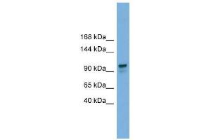 Western Blot showing GANAB antibody used at a concentration of 1-2 ug/ml to detect its target protein. (GANAB Antikörper  (Middle Region))