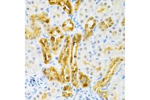 Immunohistochemistry of paraffin-embedded rat kidney using SULT2 Antibody (4063) at dilution of 1:200 (40x lens). (SULT2A1 Antikörper  (AA 1-145))