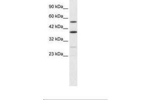Image no. 2 for anti-A Kinase (PRKA) Anchor Protein 17A (AKAP17A) (AA 48-97) antibody (ABIN6735878) (SFRS17A Antikörper  (AA 48-97))