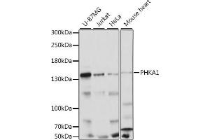 Western blot analysis of extracts of various cell lines, using PHK antibody (5700) at 1:1000 dilution. (PHKA1 Antikörper  (AA 600-820))