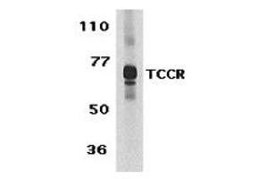 Western Blotting (WB) image for anti-Interleukin 27 Receptor, alpha (IL27RA) (C-Term) antibody (ABIN1030724)