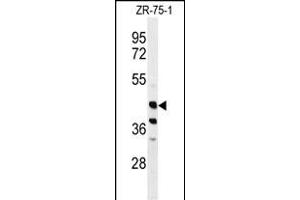 Western blot analysis of FA2H Antibody (Center) (ABIN650994 and ABIN2840028) in ZR-75-1 cell line lysates (35 μg/lane).