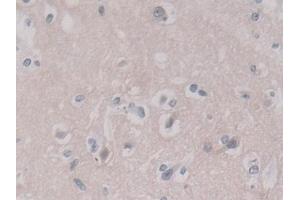 Detection of ANXA11 in Human Cerebrum Tissue using Polyclonal Antibody to Annexin A11 (ANXA11) (Annexin A11 Antikörper  (AA 1-505))