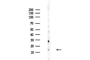 Western blot analysis of lysates from COLO205 cells, using CTAG2 Antibody at 1/1000 dilution.