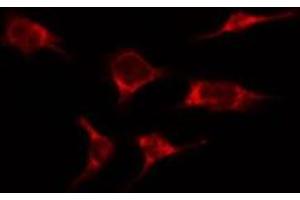 ABIN6276366 staining HepG2 by IF/ICC. (IL-2 Antikörper  (Internal Region))