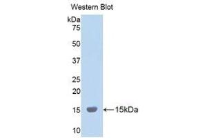 Western Blotting (WB) image for anti-Lysyl Oxidase-Like 2 (LOXL2) (AA 323-427) antibody (ABIN1859684) (LOXL2 Antikörper  (AA 323-427))