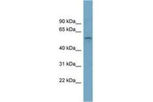 Image no. 1 for anti-Solute Carrier Family 22, Member 15 (SLC22A15) (AA 359-408) antibody (ABIN6743223) (SLC22A15 Antikörper  (AA 359-408))