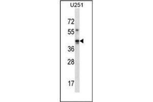 Western blot analysis of GIPC1 Antibody (N-term) in U251 cell line lysates (35ug/lane).