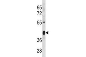Txnip antibody western blot analysis in mouse stomach tissue lysate. (TXNIP Antikörper  (AA 116-145))