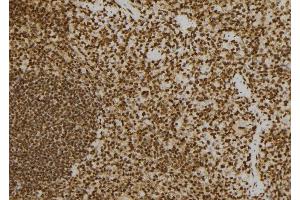 Immunohistochemistry (IHC) image for anti-Protein Kinase, Interferon-Inducible Double Stranded RNA Dependent Activator (PRKRA) (Internal Region) antibody (ABIN6264430)