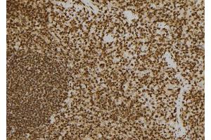 ABIN6277577 at 1/100 staining Mouse spleen tissue by IHC-P. (PRKRA Antikörper  (Internal Region))