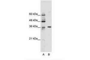 Image no. 1 for anti-Zinc Finger Protein 124 (ZNF124) (N-Term) antibody (ABIN202167) (ZNF124 Antikörper  (N-Term))