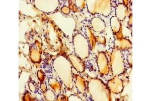 Immunohistochemistry of paraffin-embedded human thyroid tissue using ABIN7169807 at dilution of 1:100 (SLITRK6 Antikörper  (AA 621-821))