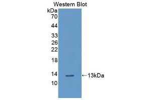 Western blot analysis of the recombinant protein. (PLXNB1 Antikörper  (AA 581-727))