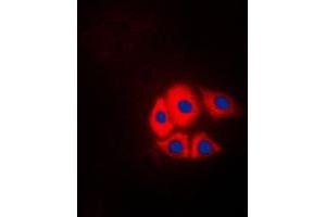 Immunofluorescent analysis of p130 Cas (pY249) staining in NIH3T3 cells. (BCAR1 Antikörper  (pTyr249))