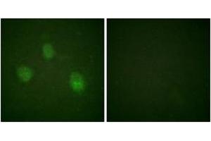 Immunofluorescence analysis of HeLa cells, using AurB (Ab-12) Antibody. (Aurora Kinase B Antikörper  (AA 1-50))