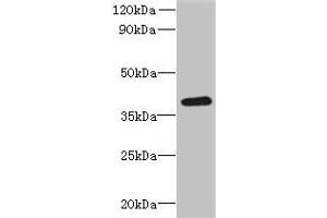 Western blot All lanes: RSPH14 antibody at 8 μg/mL + 293T whole cell lysate Secondary Goat polyclonal to rabbit IgG at 1/10000 dilution Predicted band size: 39 kDa Observed band size: 39 kDa (RTDR1 Antikörper  (AA 1-230))