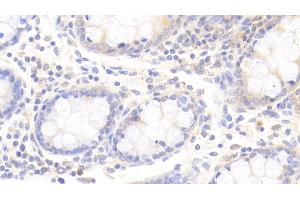 Immunohistochemistry (IHC) image for anti-Apolipoprotein D (APOD) (AA 21-189) antibody (ABIN7434431)