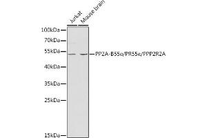 Western Blotting (WB) image for anti-Protein Phosphatase 2 Regulatory Subunit 2A (PPP2R2A) (AA 1-447) antibody (ABIN3023154)