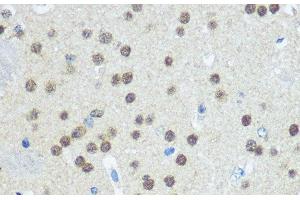 Immunohistochemistry of paraffin-embedded Mouse brain using UBA1 Polyclonal Antibody at dilution of 1:100 (40x lens). (UBA1 Antikörper)