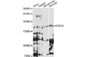 Western blot analysis of extracts of various cell lines, using CDK12 antibody (ABIN6291897) at 1:1000 dilution. (CDK12 Antikörper)