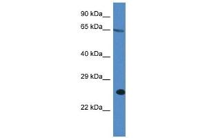 Western Blot showing ITPRIP antibody used at a concentration of 1 ug/ml against A549 Cell Lysate (ITPRIP Antikörper  (C-Term))
