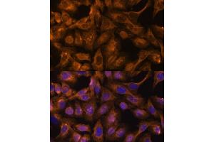 Immunofluorescence analysis of U-2 OS cells using 43713 antibody (ABIN6128759, ABIN6147556, ABIN6147557 and ABIN6216776) at dilution of 1:100. (Septin 5 Antikörper  (AA 1-369))