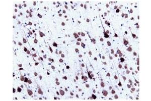 Immunohistochemistry (IHC) image for anti-Small Nuclear Ribonucleoprotein Polypeptide N (SNRPN) (AA 14-174) antibody (ABIN968086) (SNRPN Antikörper  (AA 14-174))