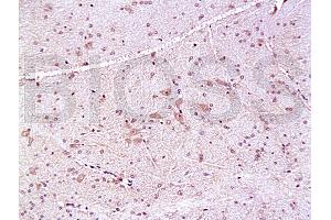 Formalin-fixed and paraffin embedded: rat brain tissue labeled with Anti-PMP22 Polyclonal Antibody, Unconjugated (ABIN726680) at 1:200, followed by conjugation to the secondary antibody and DAB staining (PMP22 Antikörper  (AA 101-160))