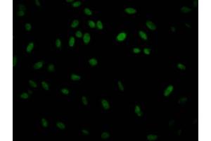 Immunofluorescence staining of Hela Cells with ABIN7127566 at 1:50, counter-stained with DAPI. (Rekombinanter IKBKB Antikörper)
