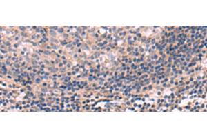 Immunohistochemistry of paraffin-embedded Human tonsil tissue using KCNT1 Polyclonal Antibody at dilution of 1:30(x200) (KCNT1 Antikörper)