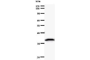 Western Blotting (WB) image for anti-Caspase Recruitment Domain Family, Member 8 (CARD8) antibody (ABIN930979) (CARD8 Antikörper)