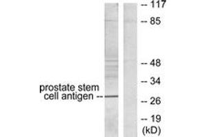 Western blot analysis of extracts from HepG2 cells, using Prostate Stem Cell Antigen Antibody. (PSCA Antikörper  (AA 41-90))