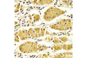 Immunohistochemistry of paraffin-embedded Human gastric using PRKAA1 antibody at dilution of 1:100 (x400 lens).