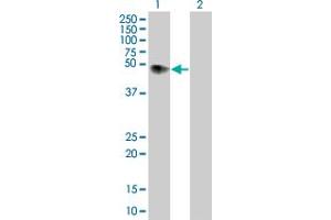Western Blotting (WB) image for F2R 293T Cell Transient Overexpression Lysate(Denatured) (ABIN1331757)