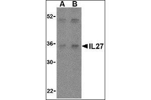 Image no. 2 for anti-Interleukin-27 Subunit alpha (IL27) (Center) antibody (ABIN372920) (IL27 Antikörper  (Center))