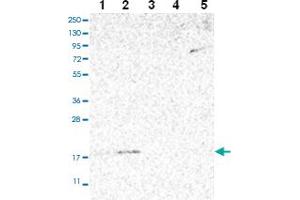Western blot analysis of Lane 1: RT-4 Lane 2: U-251 MG Lane 3: Human Plasma Lane 4: Liver Lane 5: Tonsil with MRPS24 polyclonal antibody ( Cat # PAB28022 ) at 1:100 - 1:250 dilution. (MRPS24 Antikörper)